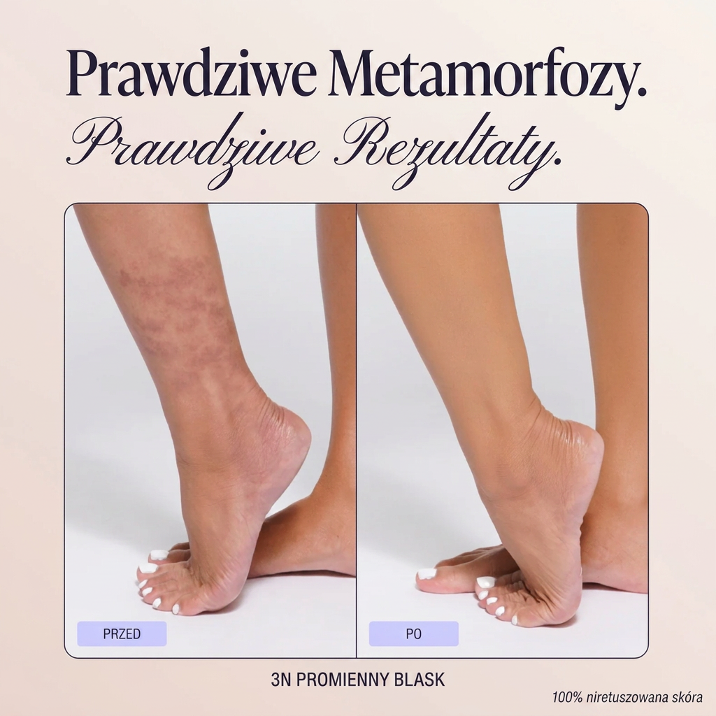 Zestaw Do Maskowania Niedoskonałości Ciała - Elouraa.pl